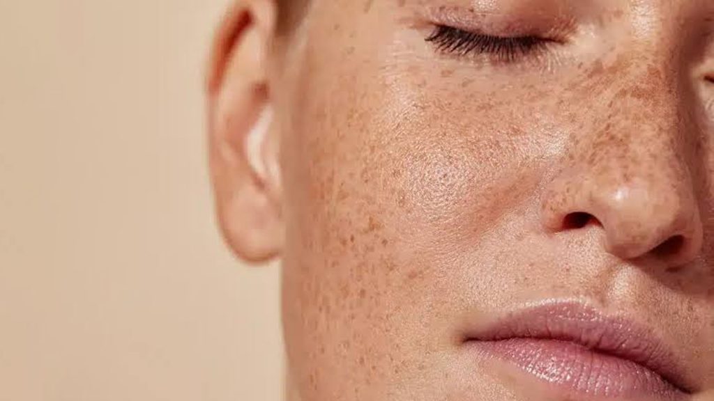 لک‌های پوستی چگونه ایجاد می‌شوند؟